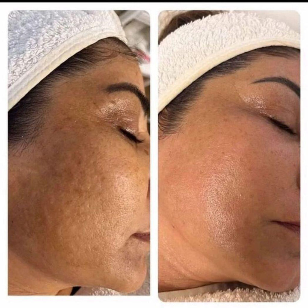 CREMA SKIN-CARE KOREANO 2% NIACINAMIDA ÁCIDO HIALURÓNICO